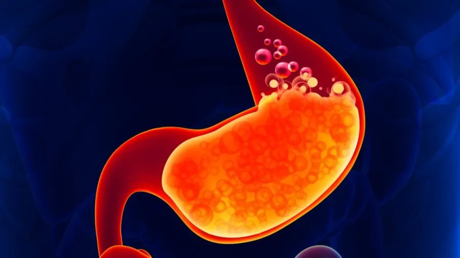 Fungsi Asam Lambung: Peran Pentingnya dalam Sistem Pencernaan