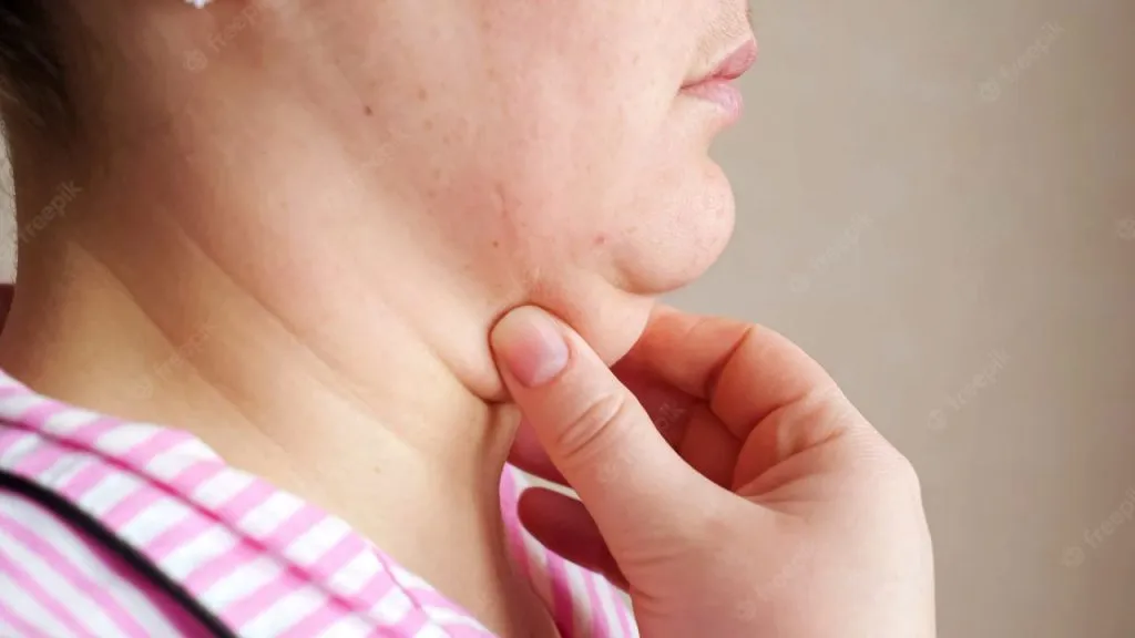 Air Putih Bisa Menghilangkan Double Chin