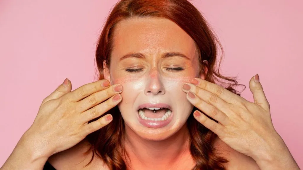 Apa yang Dilakukan Jika Terkena Sunburn?