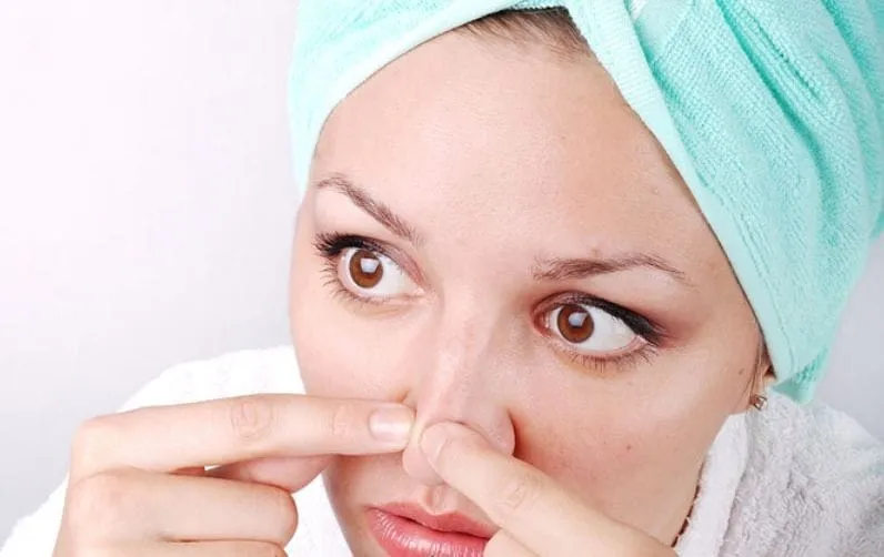 jerawat dibawah idung