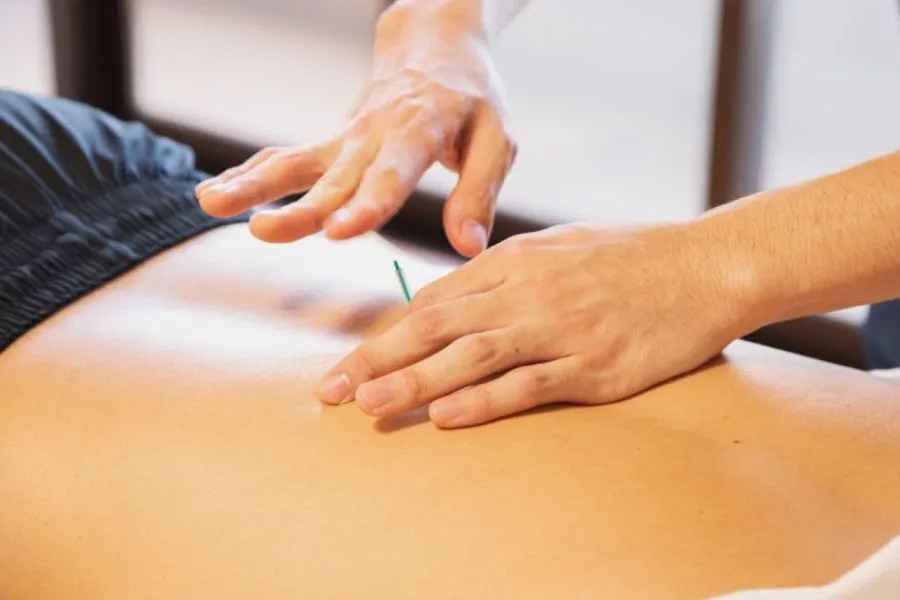 Akupunktur Asam Lambung