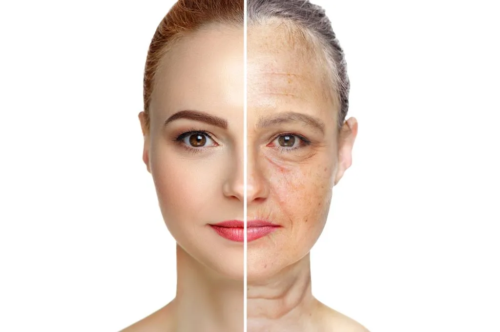 Cara Menghilangkan Keriput di Wajah