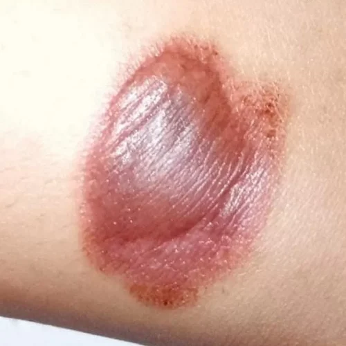 Kaki Kena Knalpot
