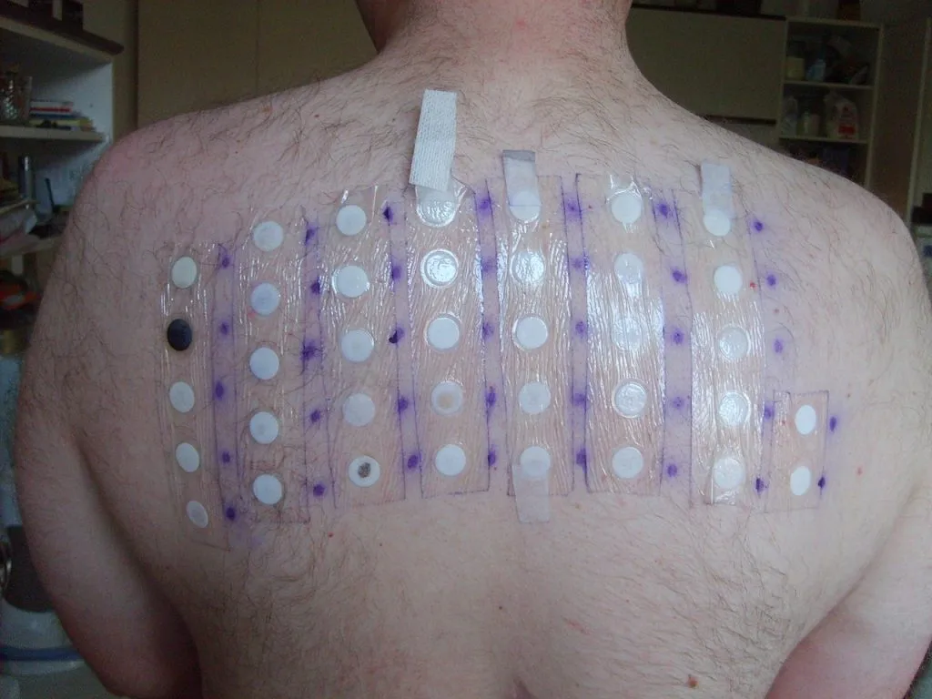 apa itu patch test