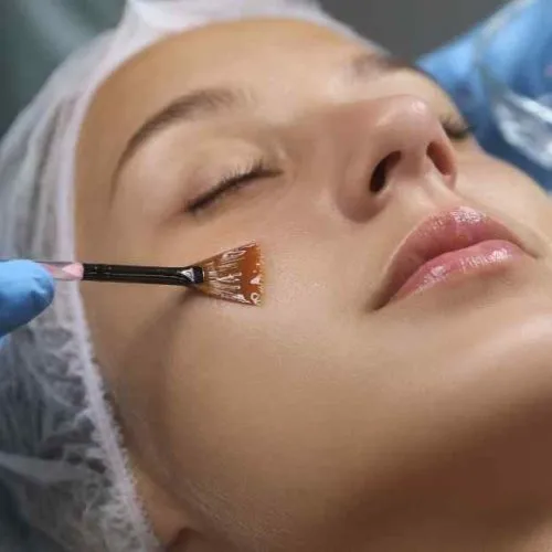 pengertian peeling