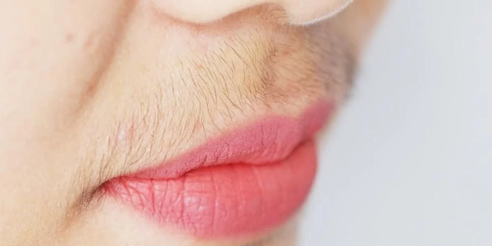 penyebab wanita berkumis