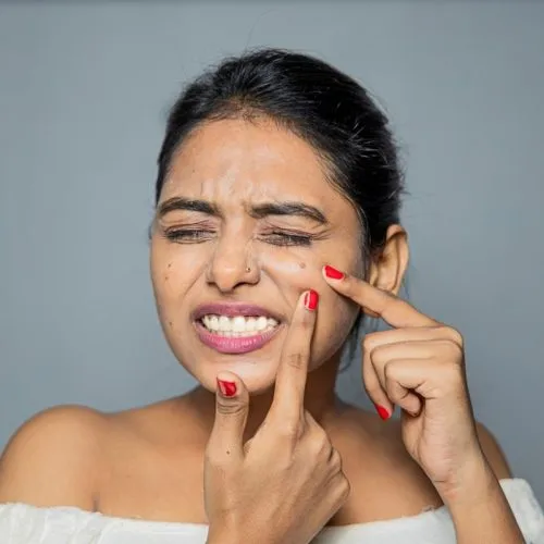 cara mencegah jerawat saat menstruasi