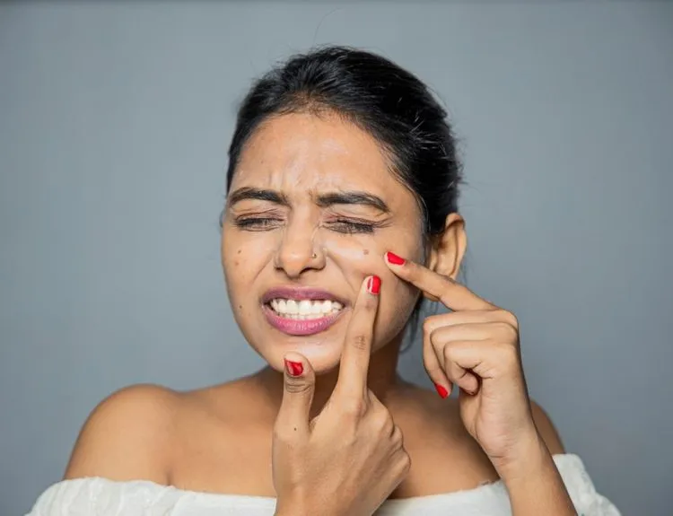 cara mencegah jerawat saat menstruasi