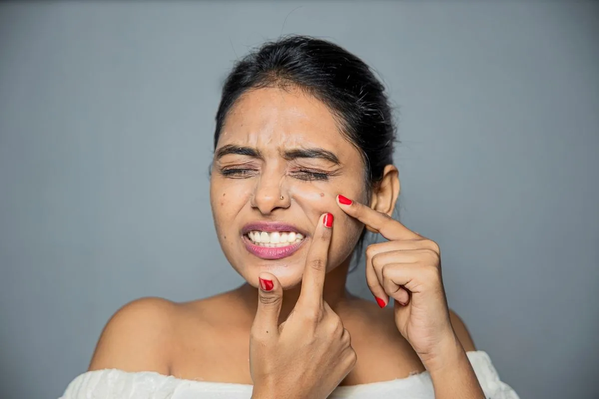cara mencegah jerawat saat menstruasi