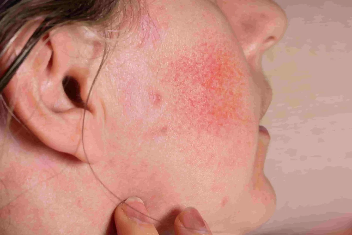 redness adalah