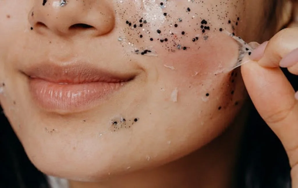 efek chemical peeling