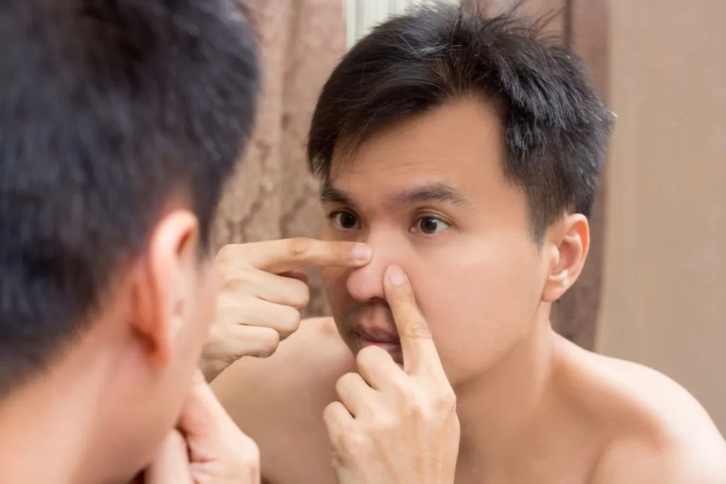 jerawat di tempat yang sama