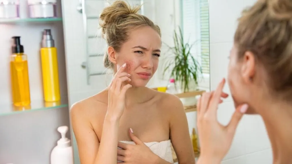 kandungan skincare yang cocok untuk kulit berminyak dan berjerawat