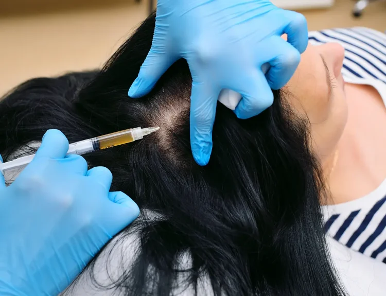 klinik rambut rontok