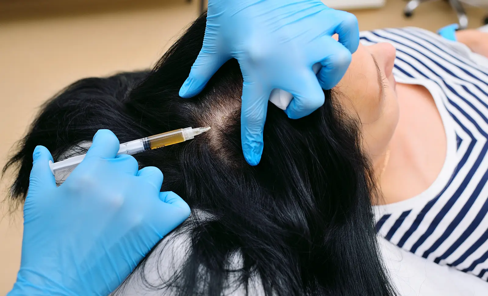 klinik rambut rontok