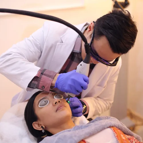 biaya laser bopeng bekas cacar