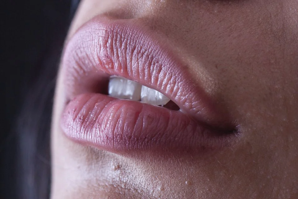 Bibir Hitam Bikin Kurang Percaya Diri? Ini Perawatan Bibir Hitam yang Mudah dan Efektif!