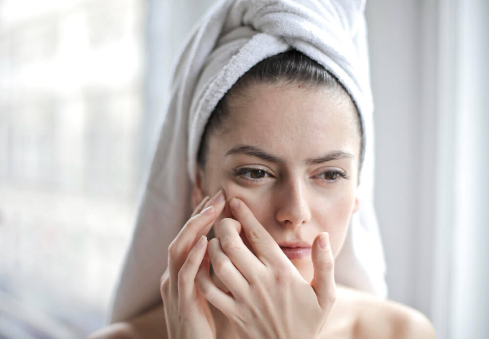 retinoid topikal untuk milia