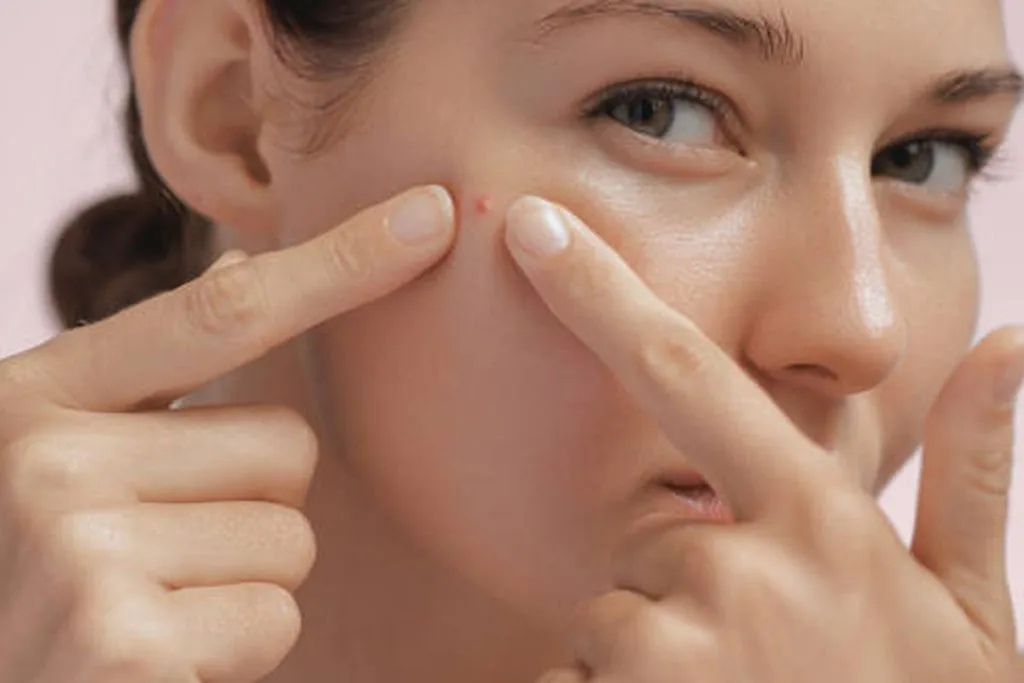 skincare untuk wajah breakout