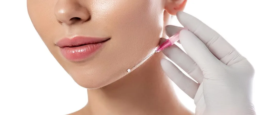 thread lift adalah