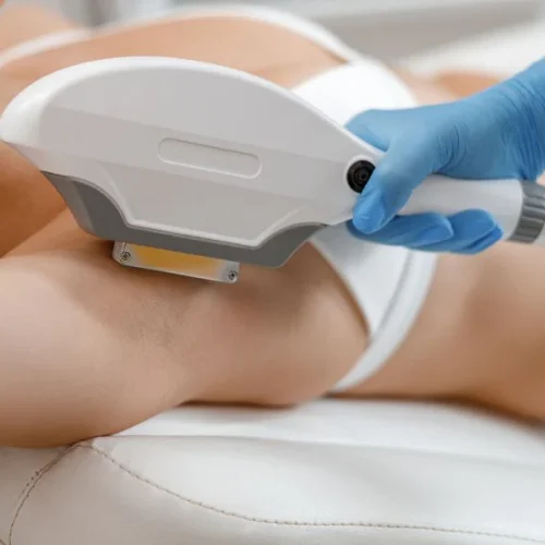treatment ipl adalah