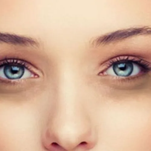 apa yang menyebabkan mata kita terlihat seperti mata panda