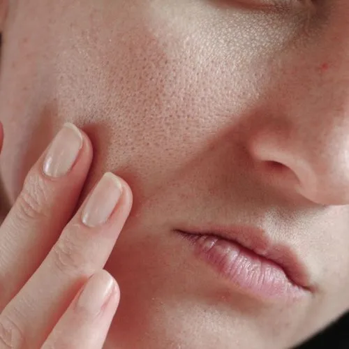 skincare untuk mengecilkan pori-pori