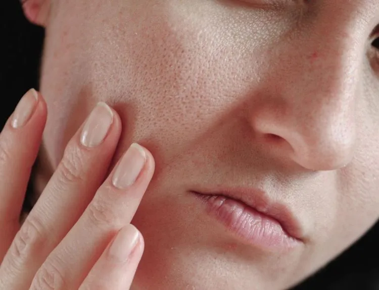 skincare untuk mengecilkan pori-pori
