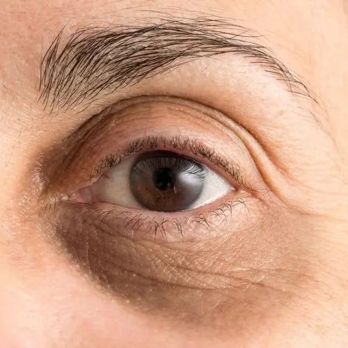 eye treatment