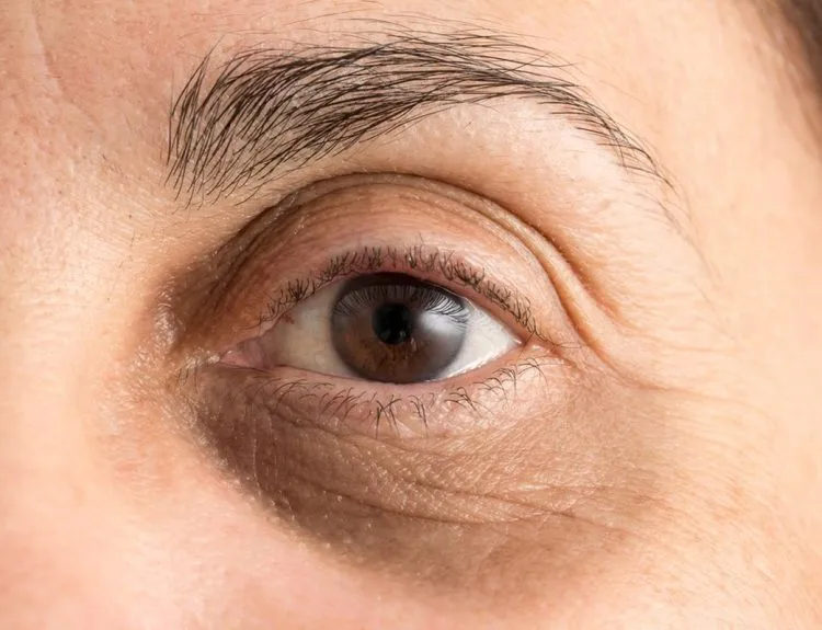 eye treatment
