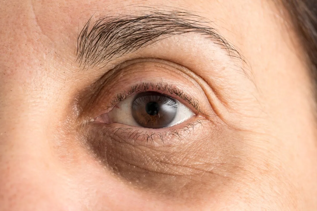 eye treatment