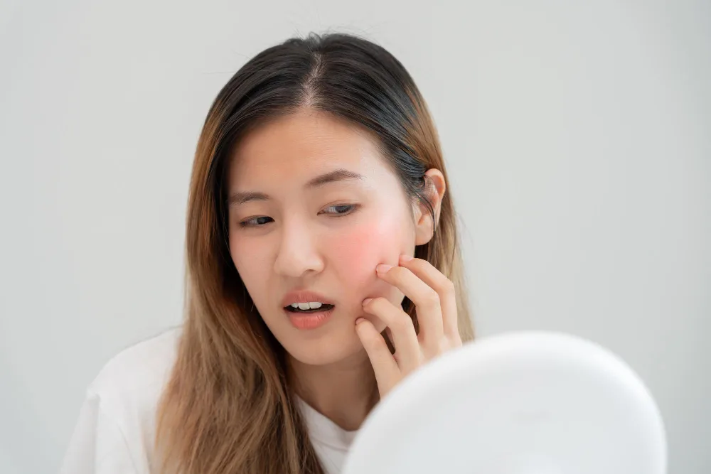 Tips Memilih Moisturizer Kulit Berminyak yang Bikin Kulitmu Fresh dan Bebas Kilap