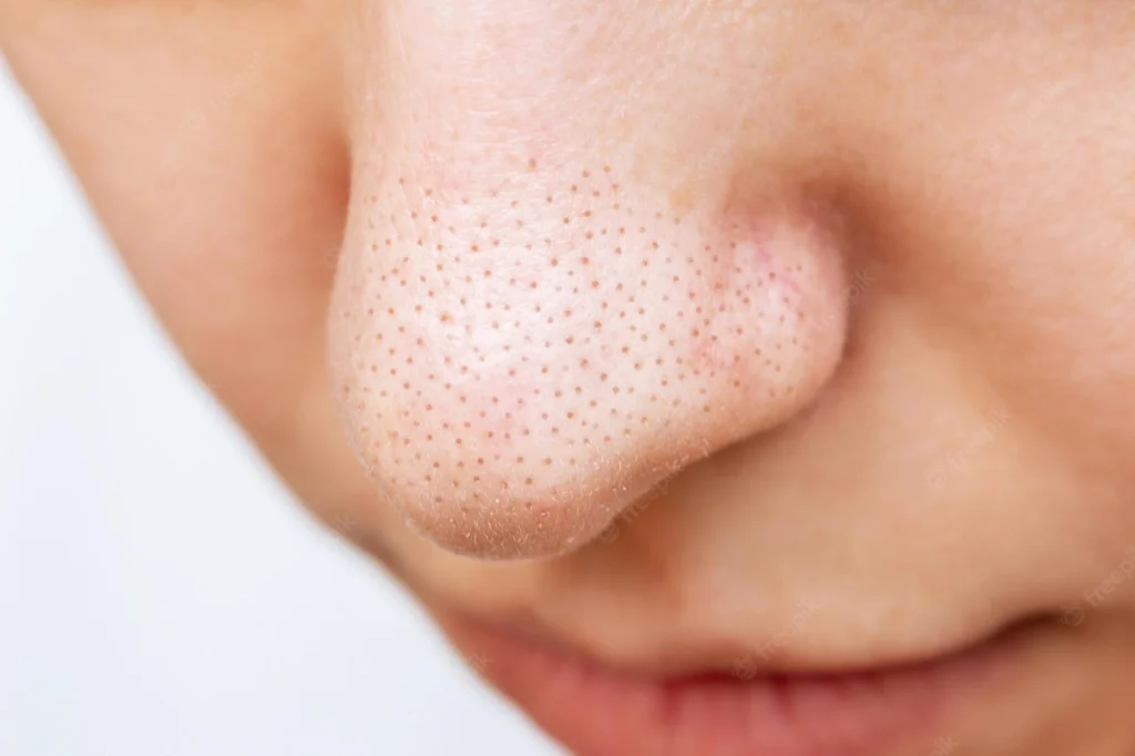 skincare untuk mengecilkan pori-pori