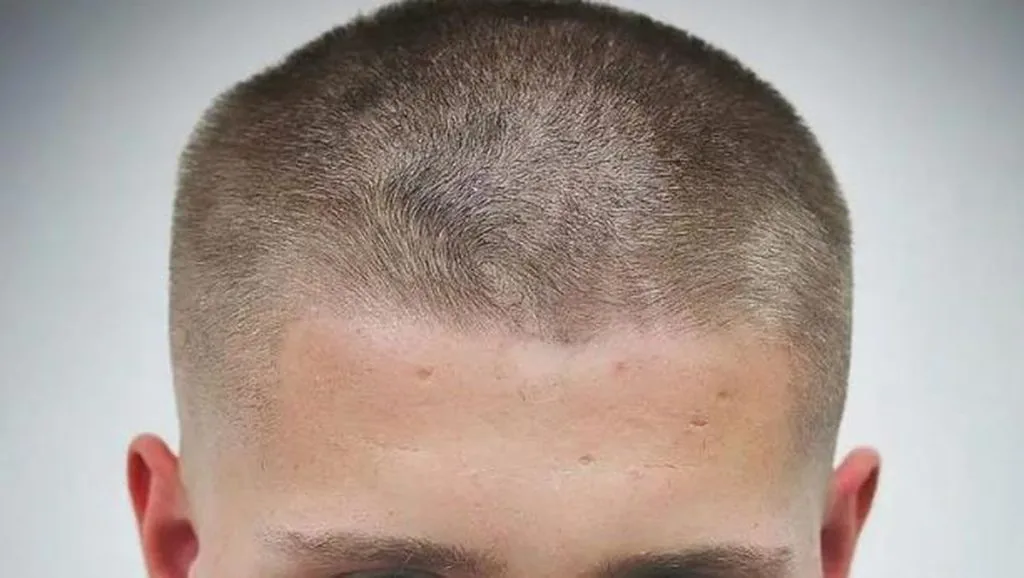 buzz cut