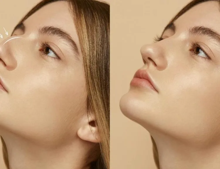 bentuk hidung
