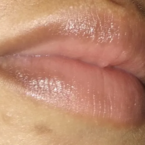 cara menghilangkan kehitaman di pinggir bibir
