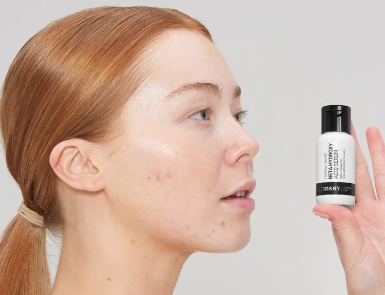 chemical exfoliant