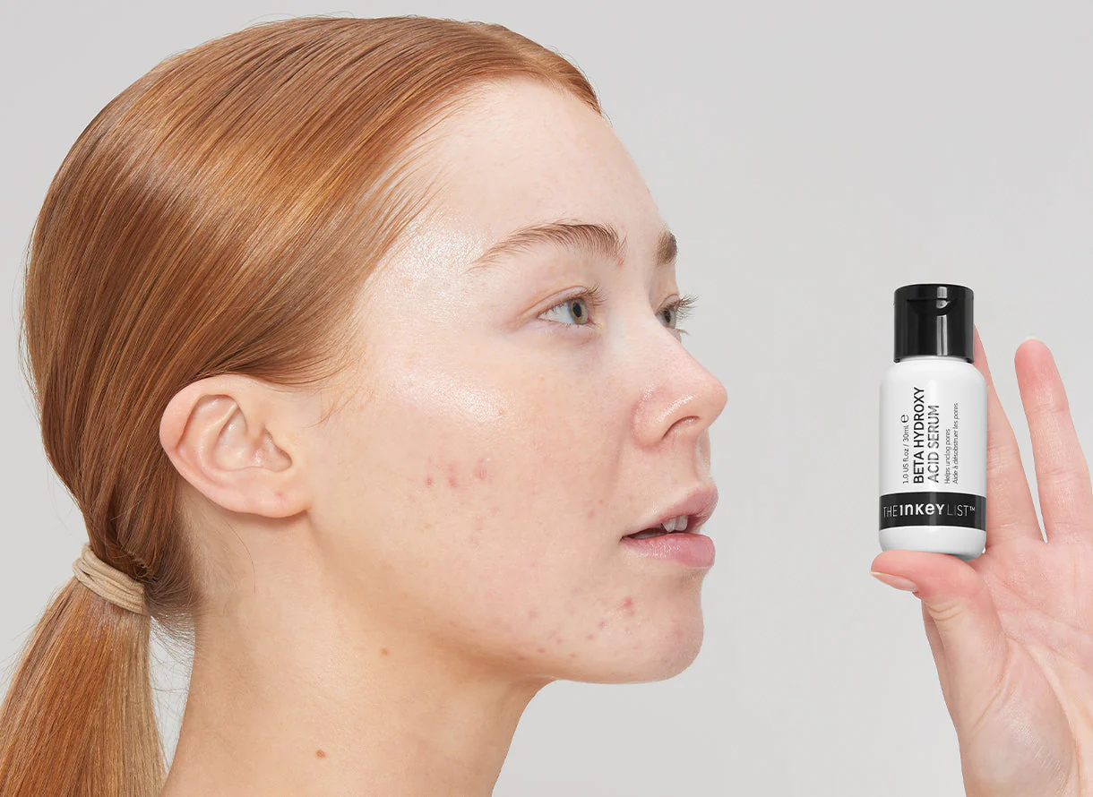 chemical exfoliant