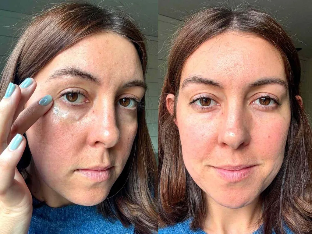eye treatment