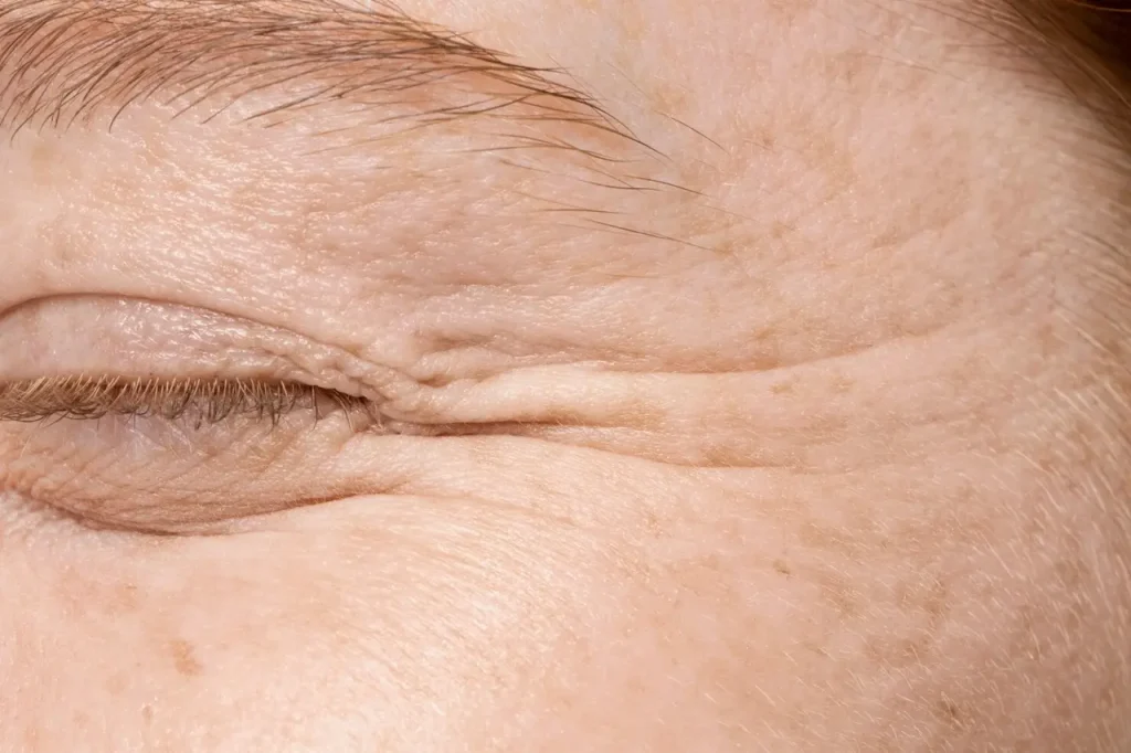 fine lines
