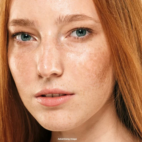 perbedaan melasma dan flek hitam