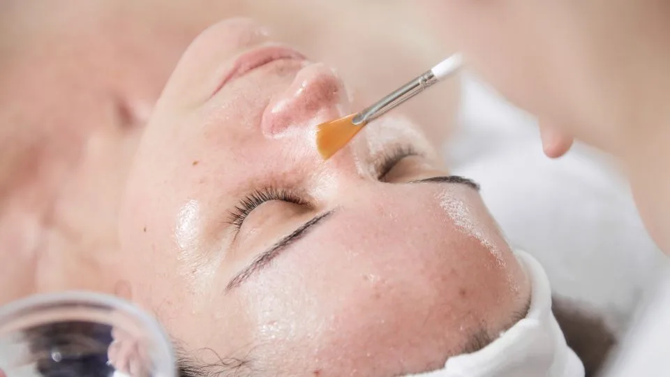 peeling adalah