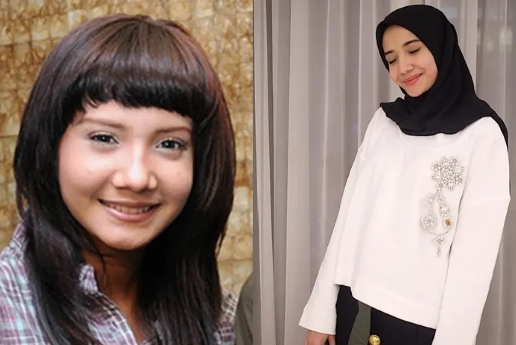 zaskia sungkar dulu