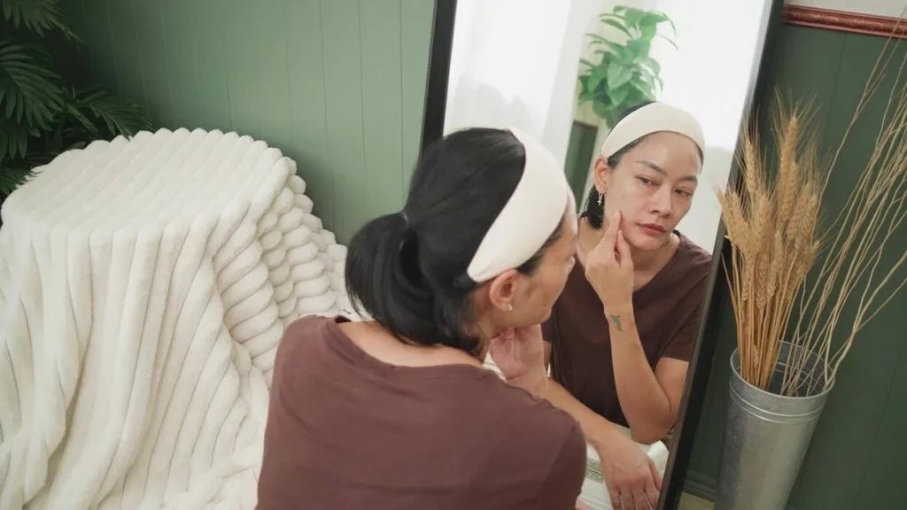 acne prone skin adalah