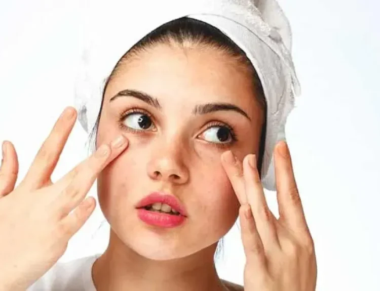 jenis kantung mata