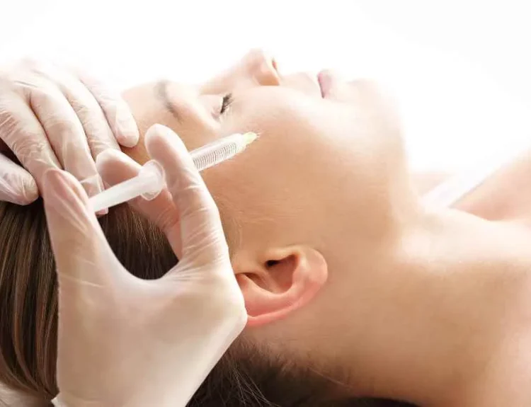 meso acne