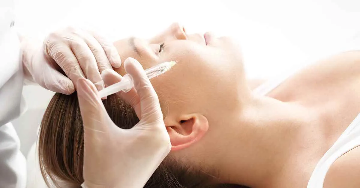 meso acne