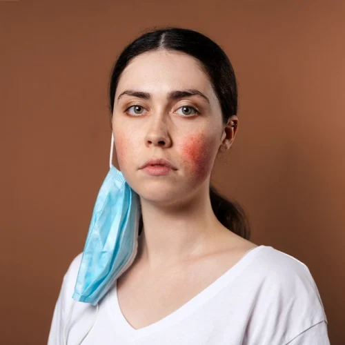 skincare untuk fungal acne