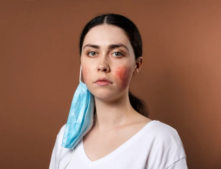 skincare untuk fungal acne