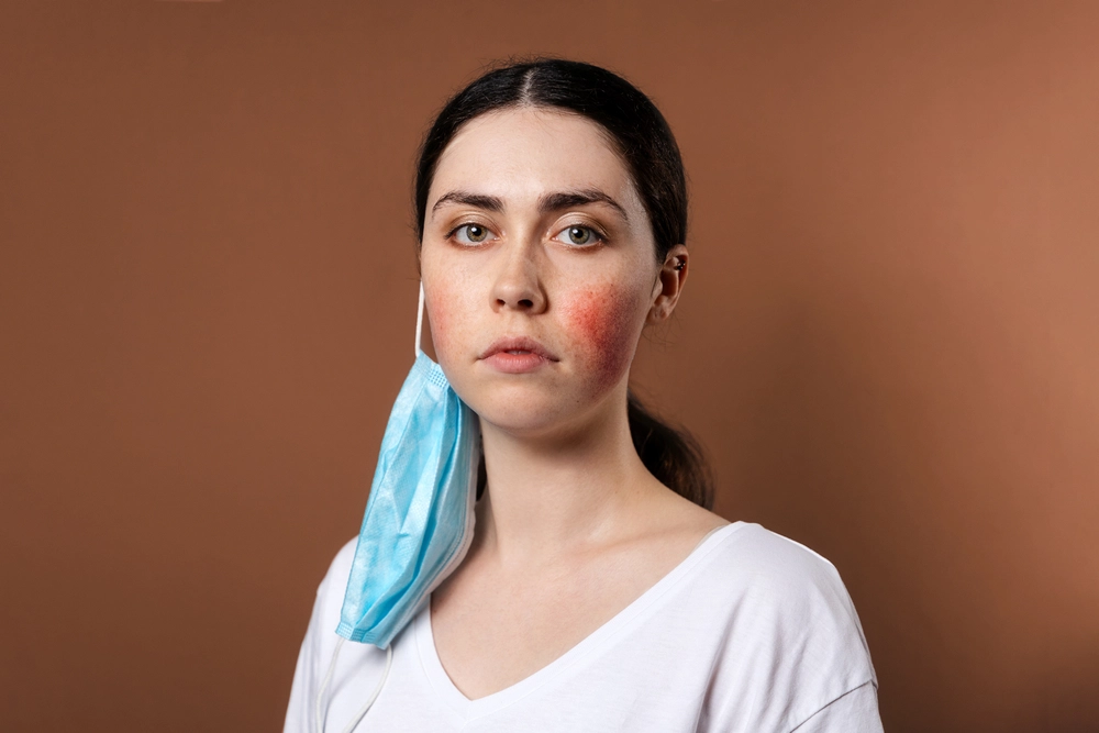 perbedaan fungal acne dan bruntusan